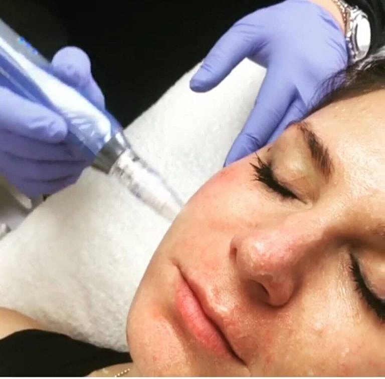 Medical Aesthetics Training To Address Skincare Concerns Of Patients