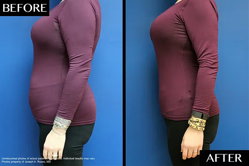 Body transformation before and after comparison.