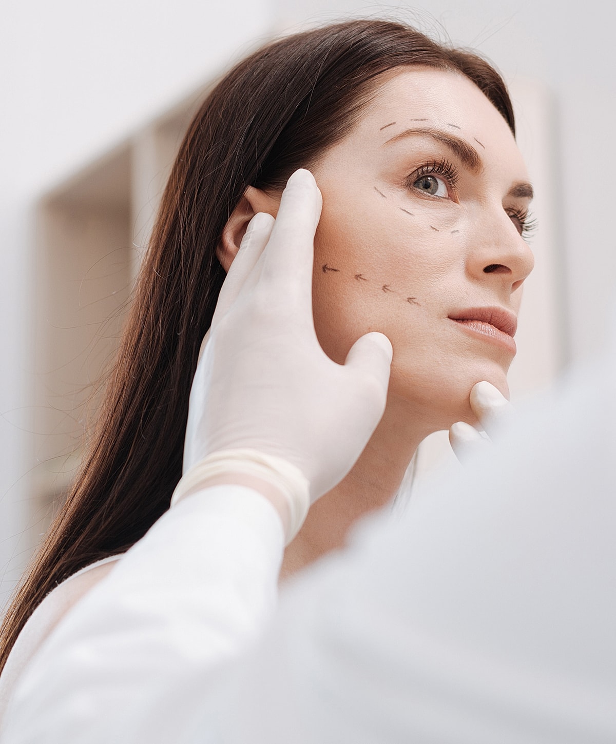 Consultation for cosmetic facial procedure markings.