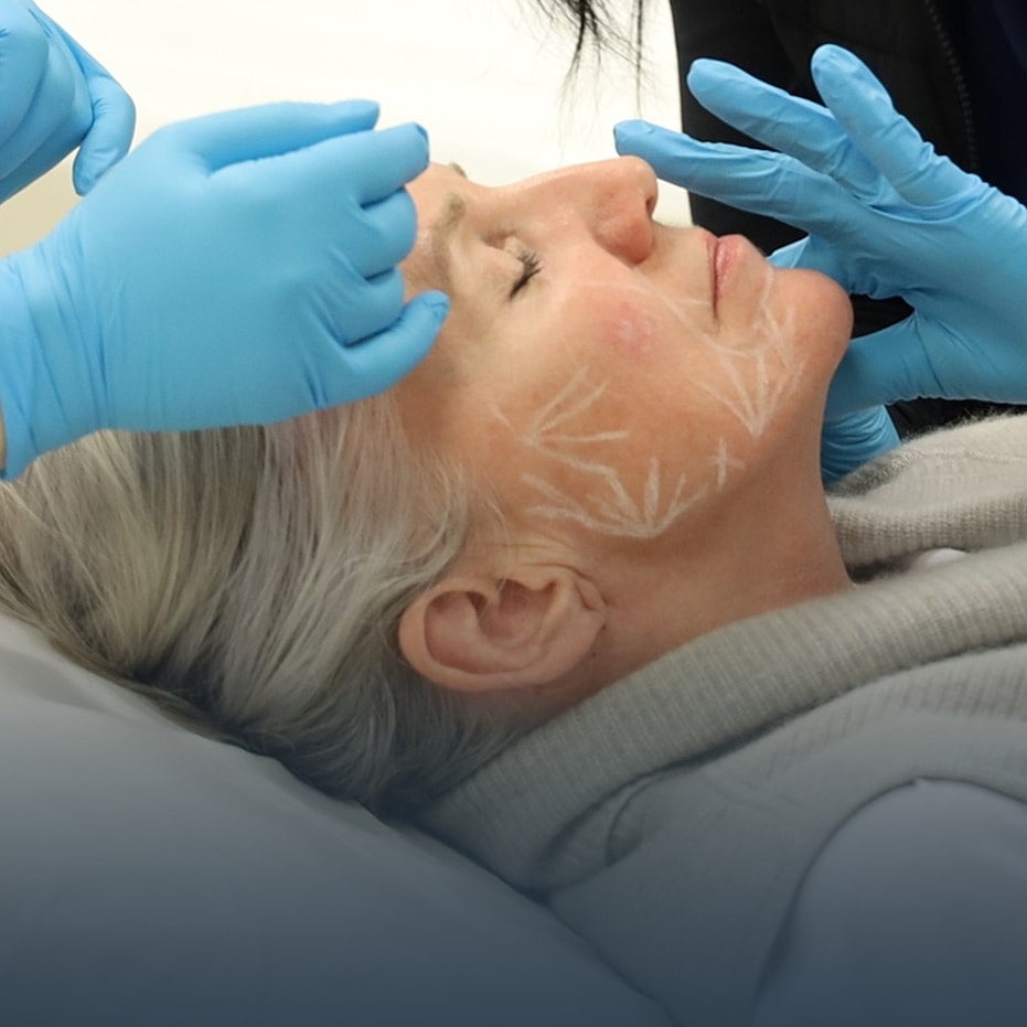 Facial treatment procedure with gloved hands.