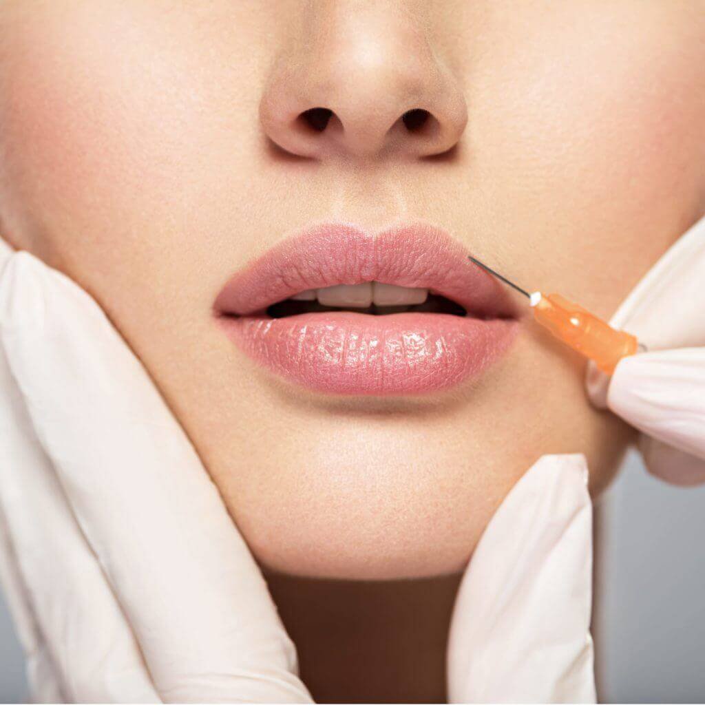 injectables patient model receiving an injection in her lips